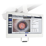 수술용 레이저 계측기